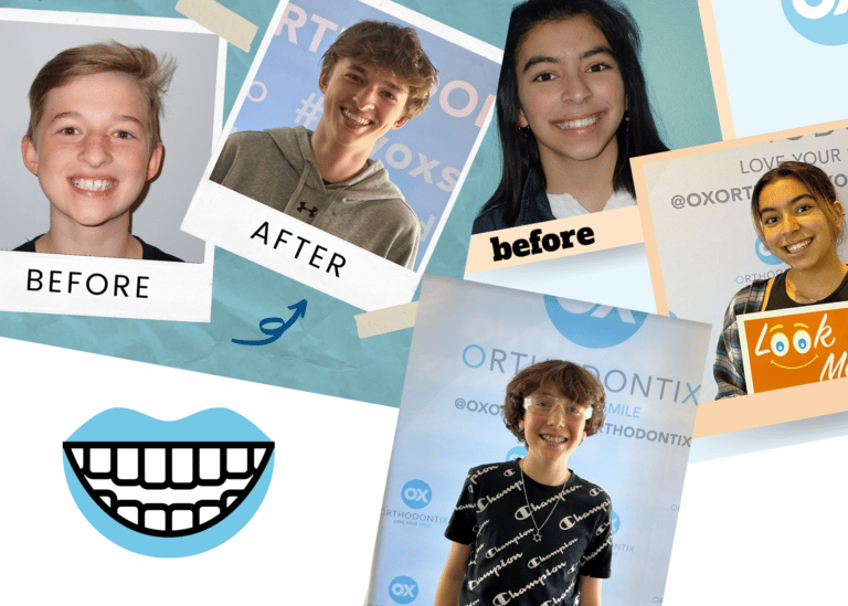 OX Orthodontix patient collage, with before and after photos