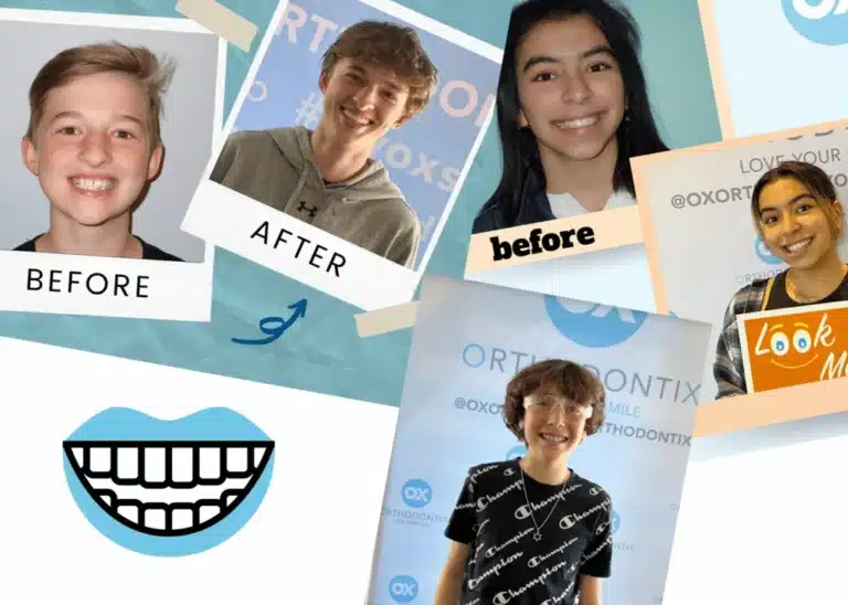 banner ox orthodontix before and after with patients